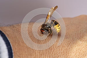 Hornet bites a manÃ¢â¬â¢s hand on a white background